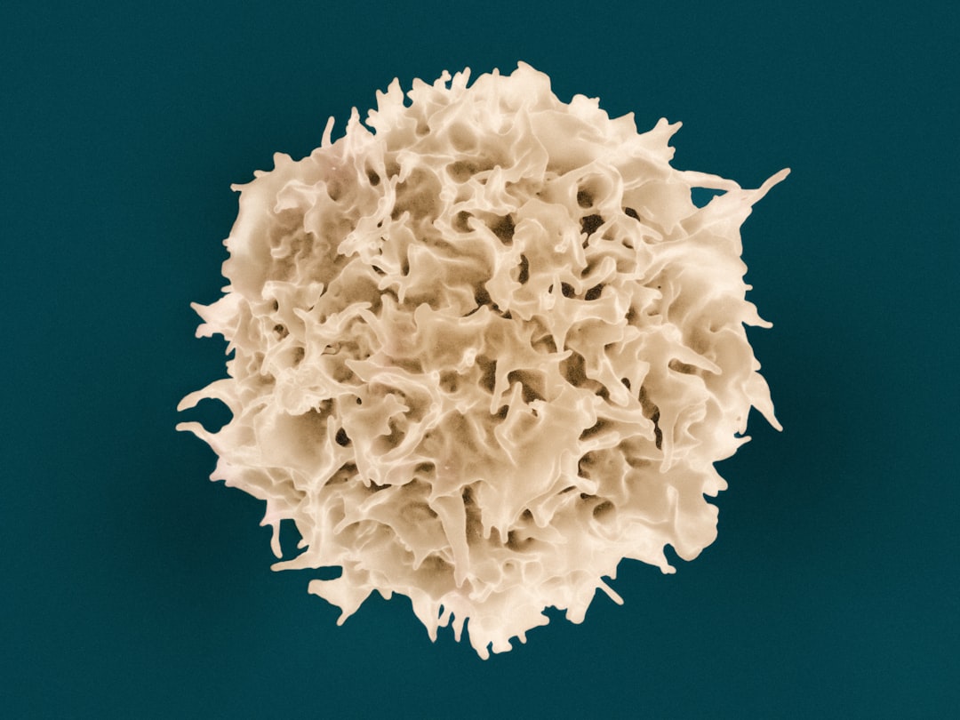 How deadly is multiple myeloma?