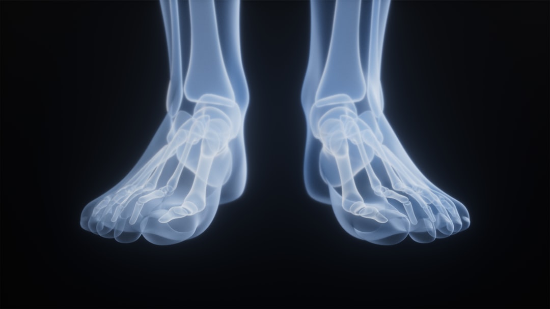 Foot Neuropathy: Two Foods You May Want to Avoid